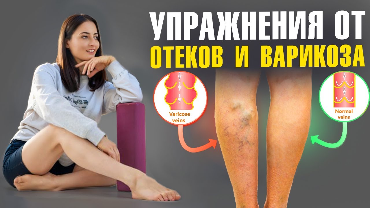 ВАРИКОЗ, ОТЕКИ и ТЯЖЕСТЬ В НОГАХ? СРОЧНО начинай делать эти простые упражнения