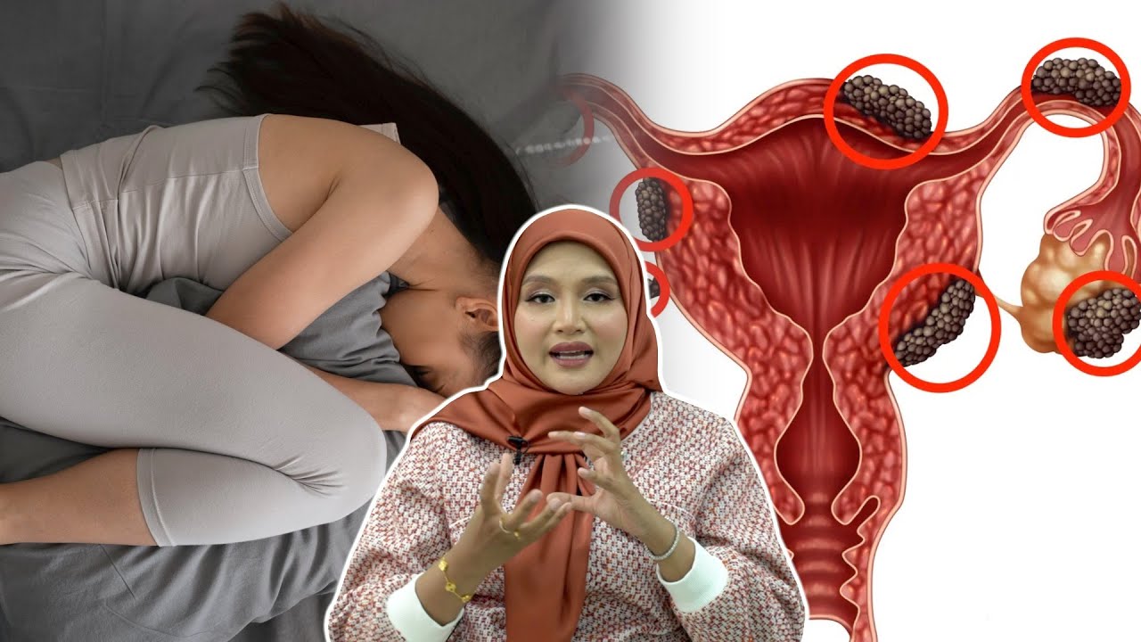 Kenapa Ada yang Senggugut Teruk, Ada yang Tak?