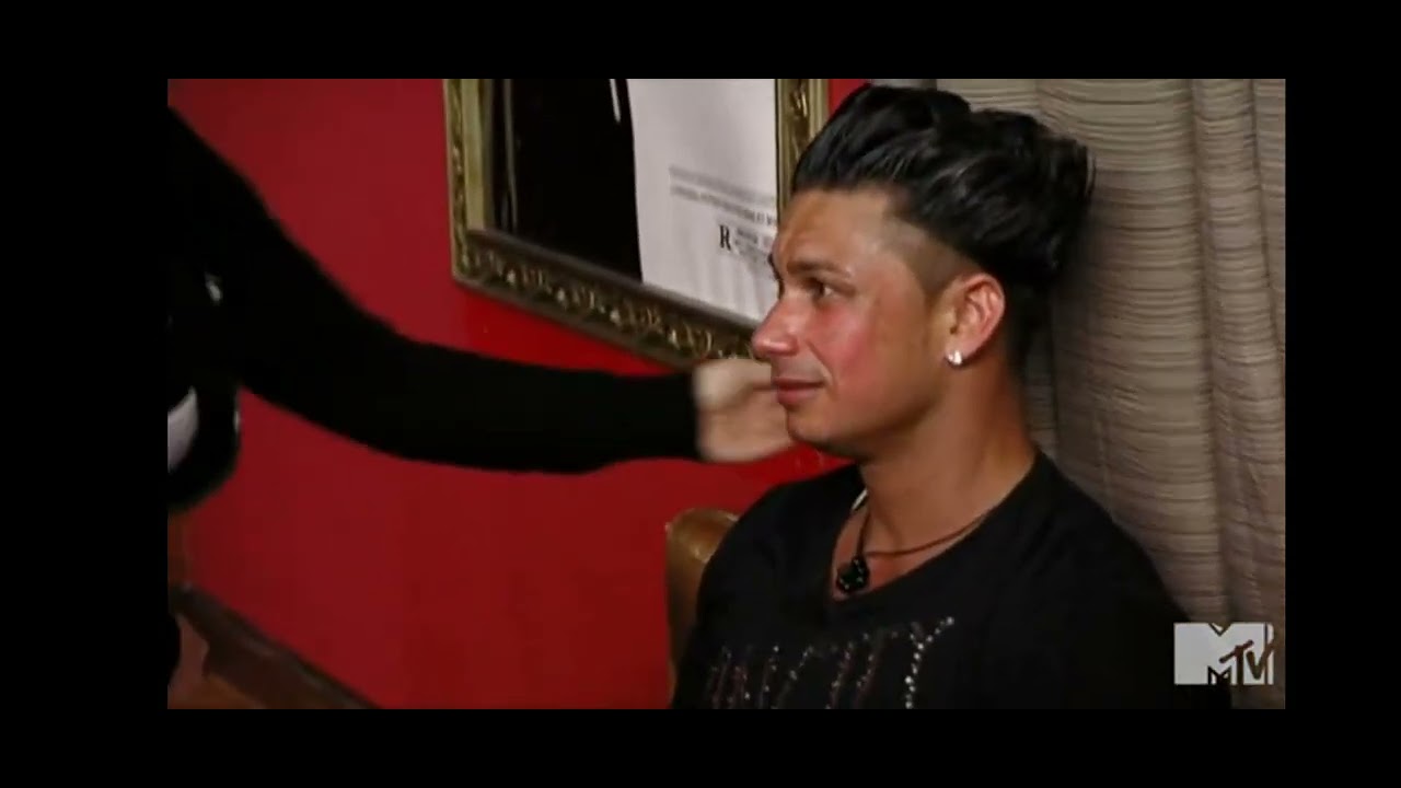 Pauly D burned his face