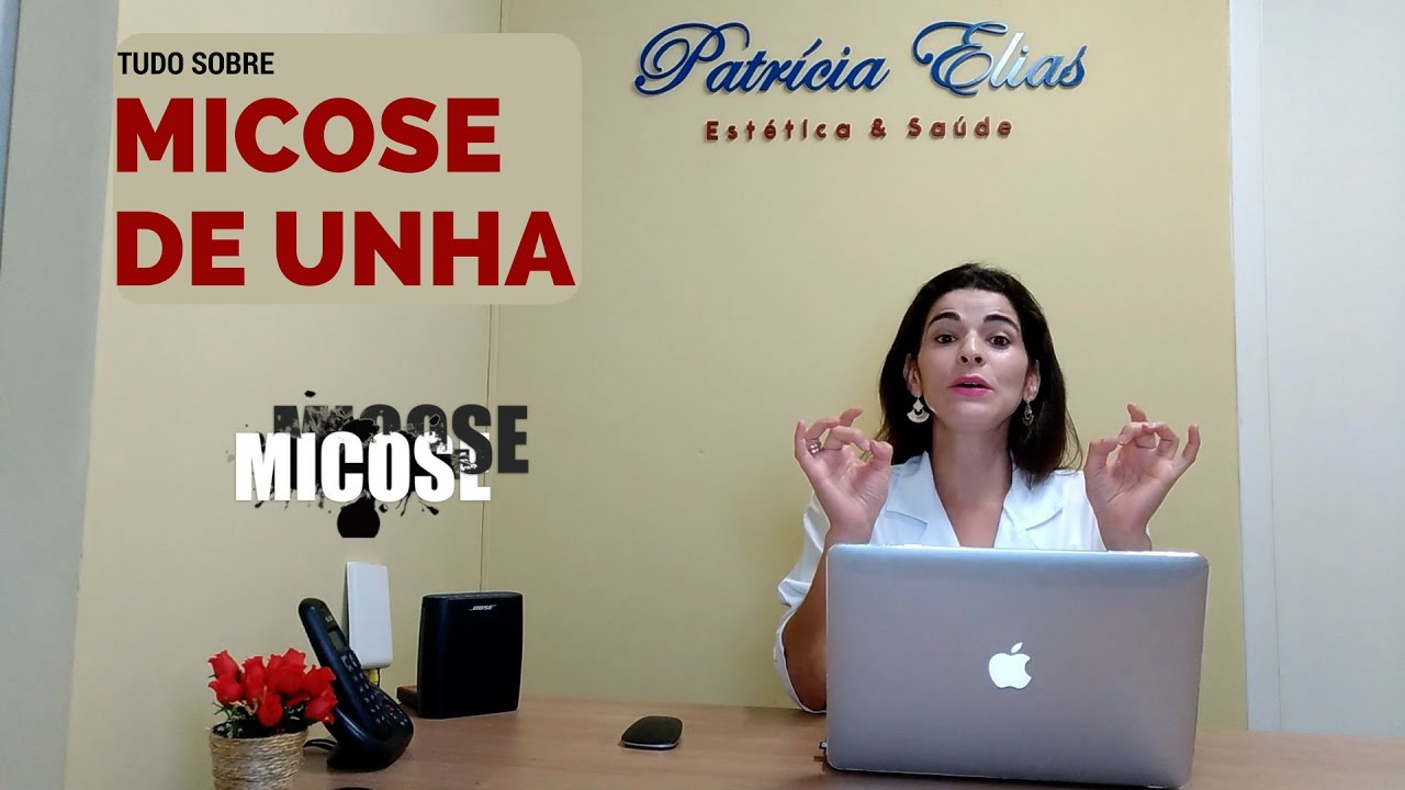 MICOSE DE UNHA | Dicas de como Prevenir, Identificar, e Home Care para Fungos de Unha.