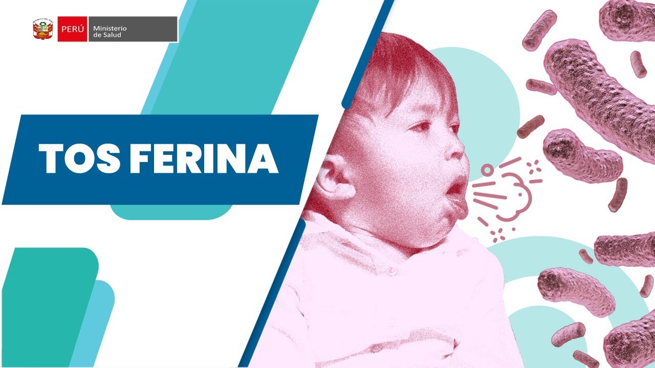 TOS FERINA