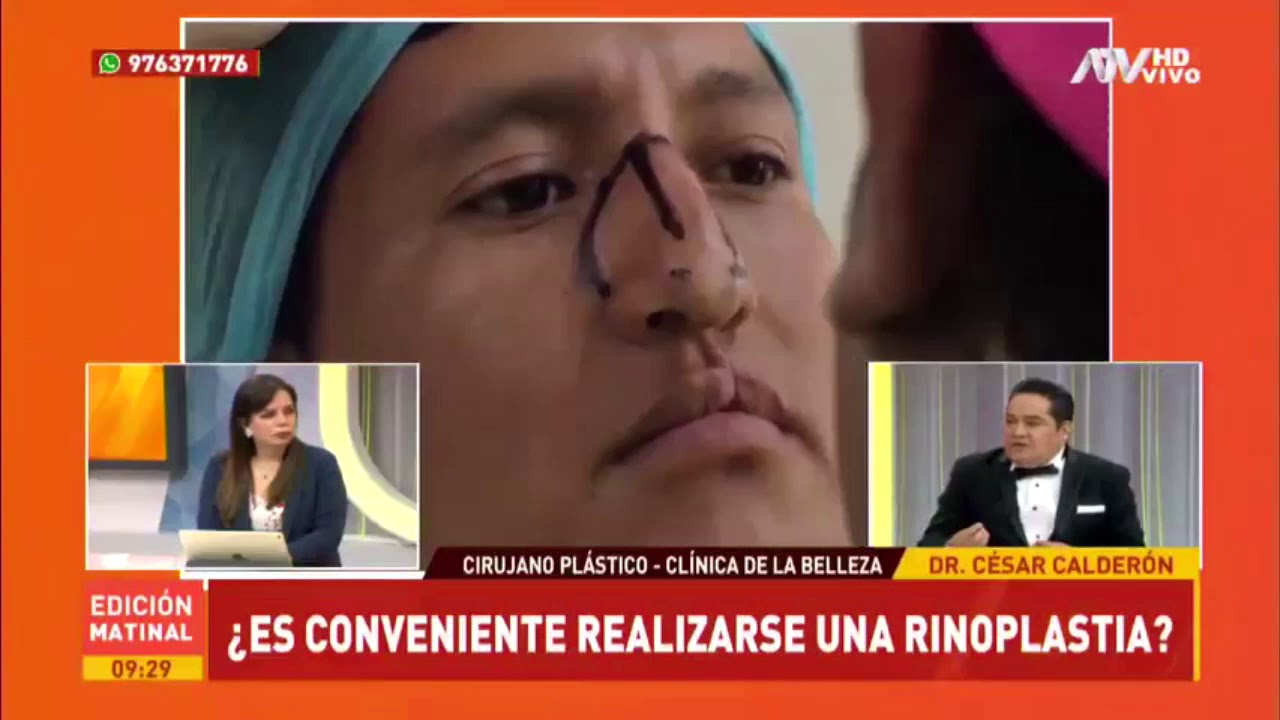 ATV NOTICIAS: RINOPLASTIA, ENTREVISTA AL DR. CÉSAR CALDERÓN