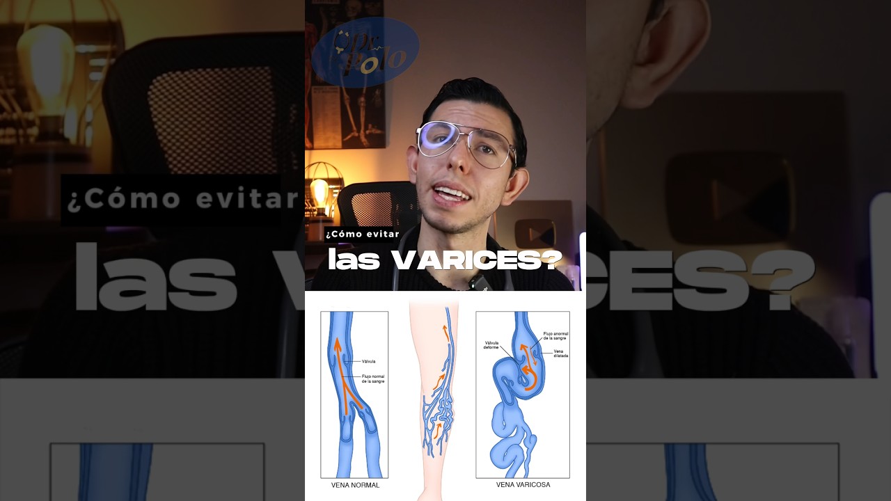 &iquest;C&oacute;mo prevenir las varices? 🤔 #sabiasesto #sabiasque #medicina