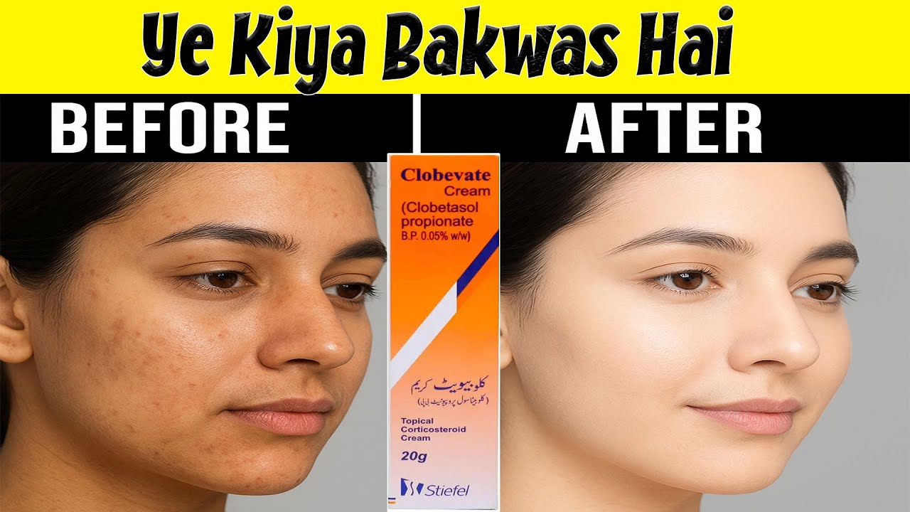 Clobevate Cream Whitening Truth 😱 | Uses, Price, Side Effects in Pakistan
