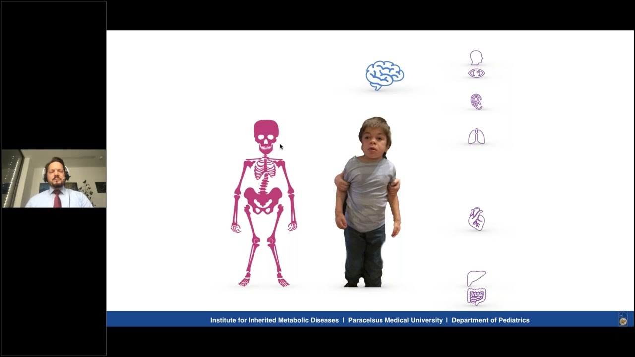 SES S4 Mucopolysaccharidoses  Clinical features and diagnosis and Enzyme Replacement Therapy