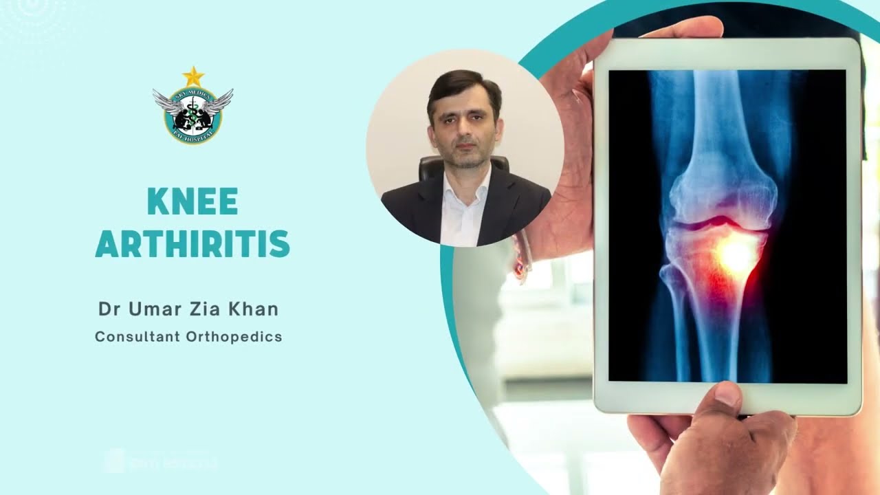 Knee Arthritis; Symptoms, Causes and Treatment | Dr Umar Zia Khan | PAF Hospital