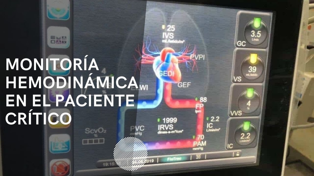 Parte 1 Módulo Hemodinamia. Fisiología del Gasto Cardíaco.