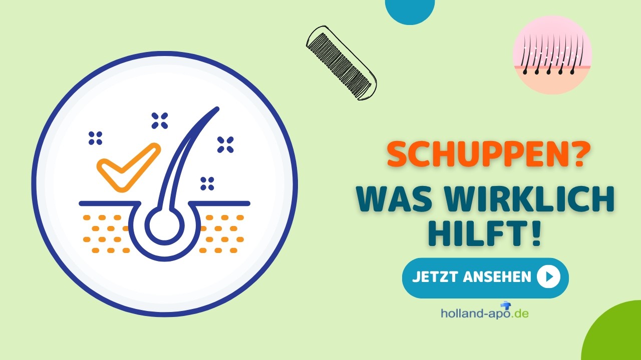 Schluss mit Schuppen &ndash; so wirst du sie endg&uuml;ltig los! ✨