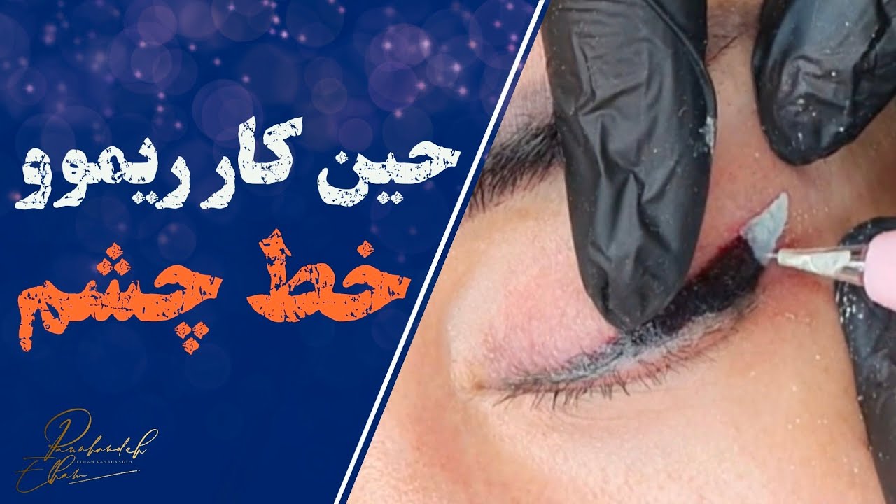 ریموو تاتوی خط چشم | نحوه نگه داشتن چشم برای پاک کردن تاتو با ریموور رژوی