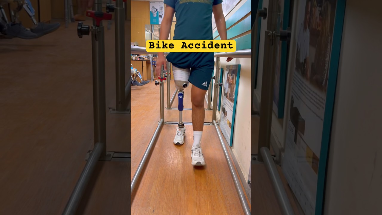 🫵Above Knee Prosthetic Leg | Ottobock 3R80 Price | Ossur Proflex XC | #ossur #3r80 #artificiallimb