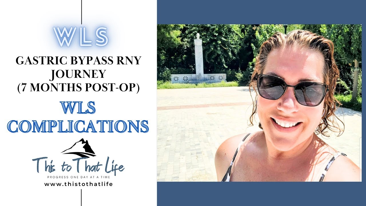7 Months Post Op Gastric Bypass Surgery WLS Journey