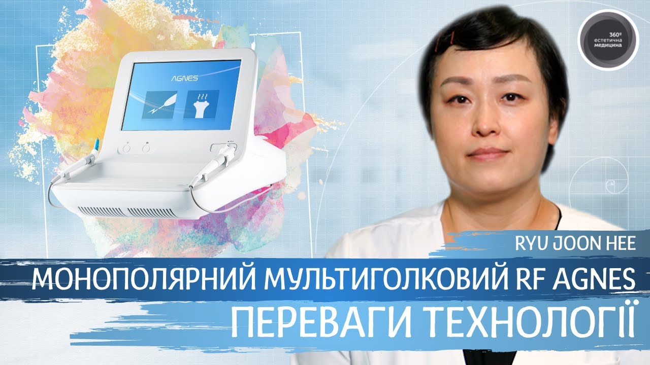 Монополярний мультиголковий RF AGNES. Переваги технології