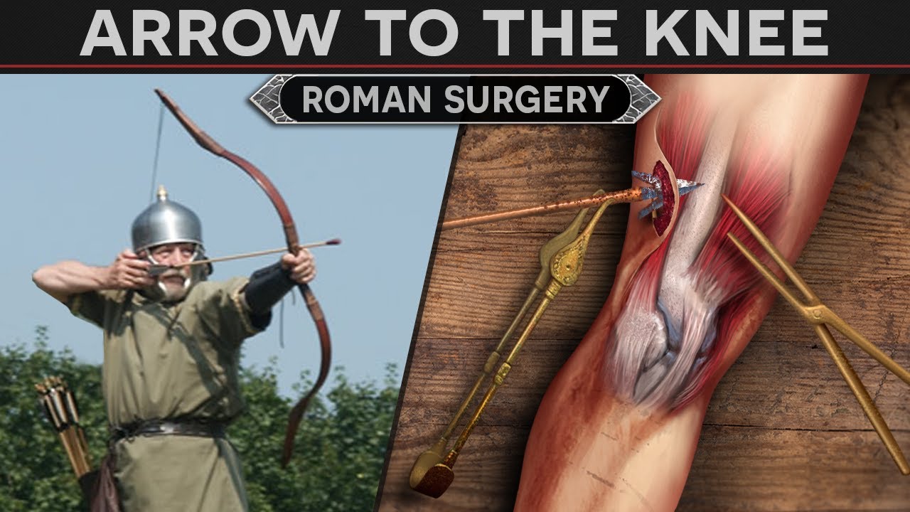 Treating an Arrow to the Knee! - Roman Surgery Techniques DOCUMENTARY