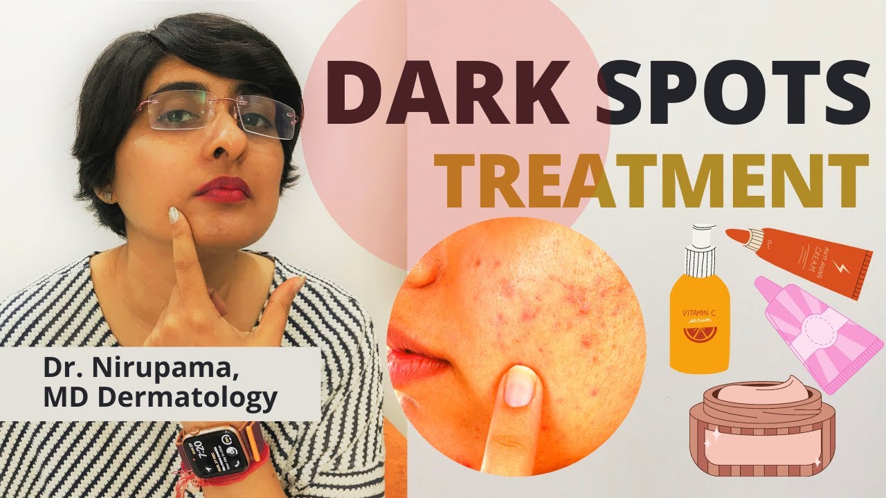 Dark Spots Treatment| How to get rid of Dark Spots| Pigmentation treatment | Dr Nirupama