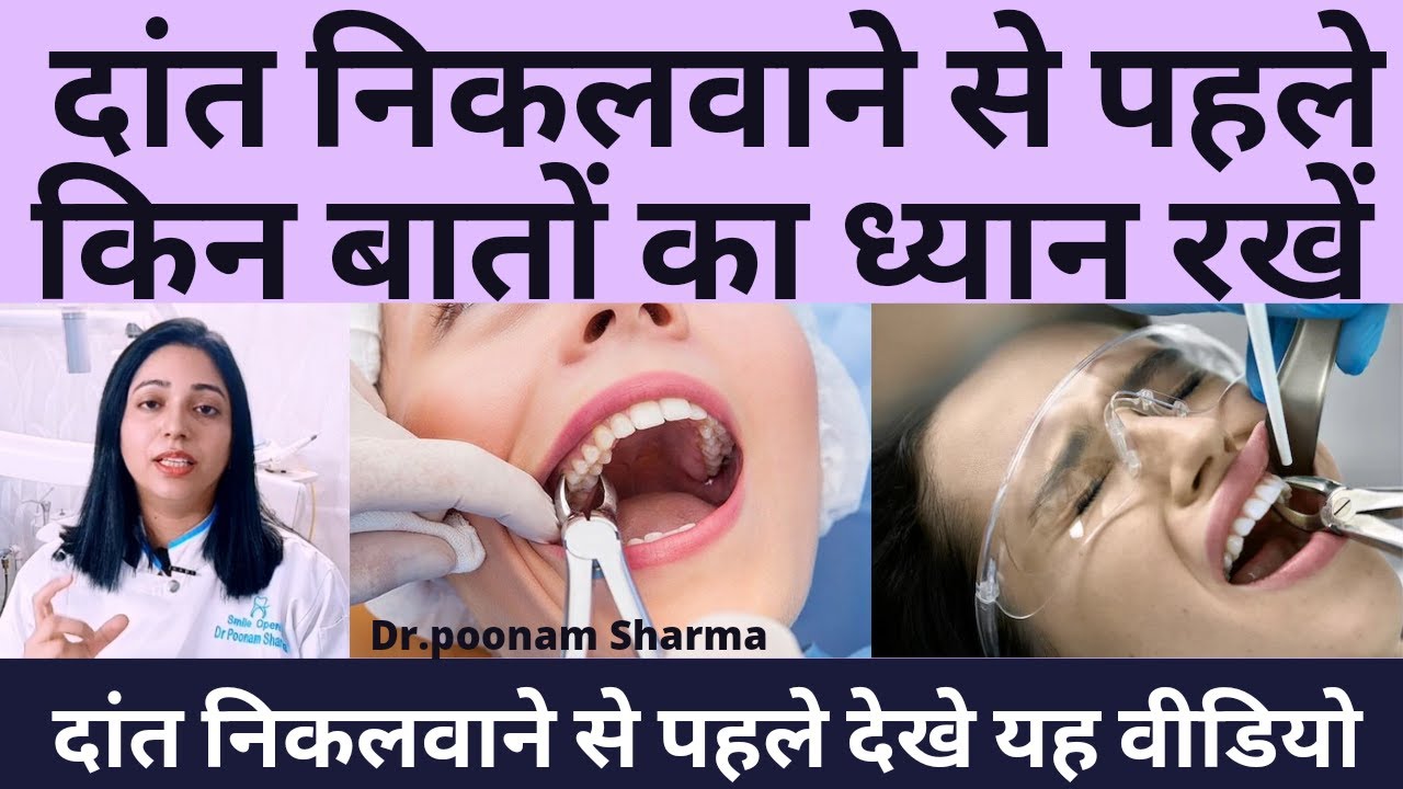 दांत निकलवाने से पहले किन बातो का ध्यान रखे ? Precautions Before And After  Tooth Extraction |