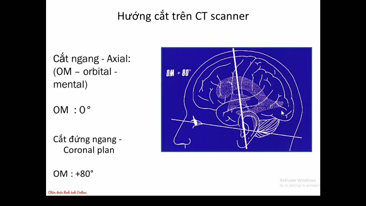 Giải phẫu điện quang não - mạch não | TS Trần Anh Tuấn