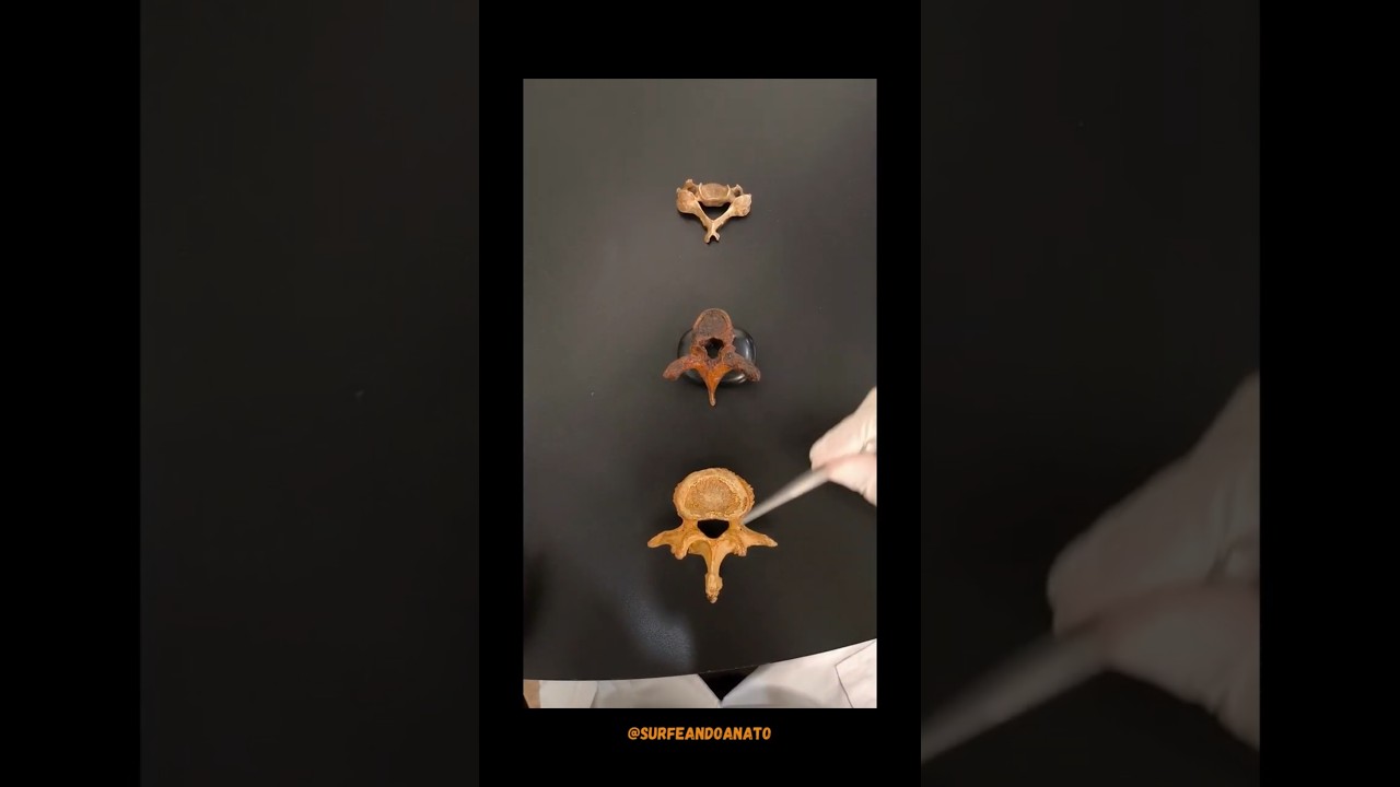 𝗗𝗜𝗙𝗘𝗥𝗘𝗡𝗖𝗜𝗔𝗦 𝗘𝗡𝗧𝗥𝗘 𝗩𝗘𝗥𝗧𝗘𝗕𝗥𝗔𝗦 🫡⁣