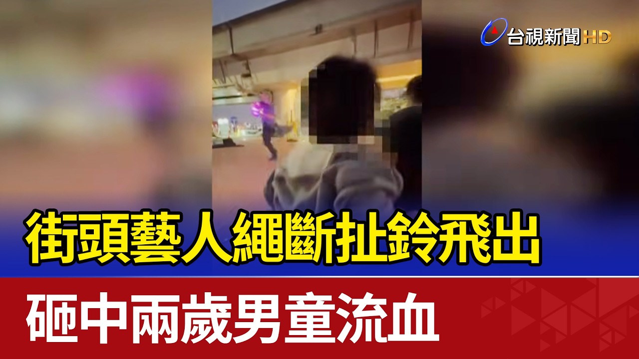 街頭藝人繩斷扯鈴飛出 砸中兩歲男童流血