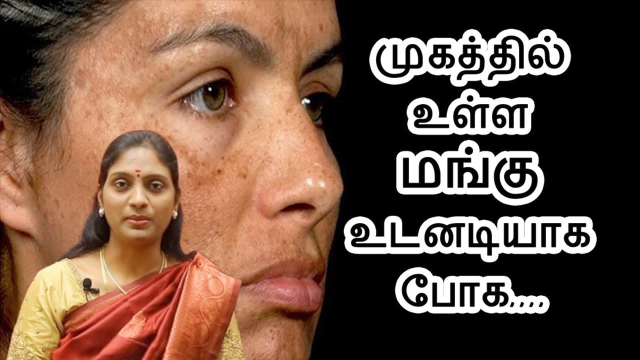 முகத்தில் சுருக்கம்,  மங்கு, கருவளையம் நீங்க | முகம் அழகு பெற.. | Dr.Nithyalakshmi | ASM INFO