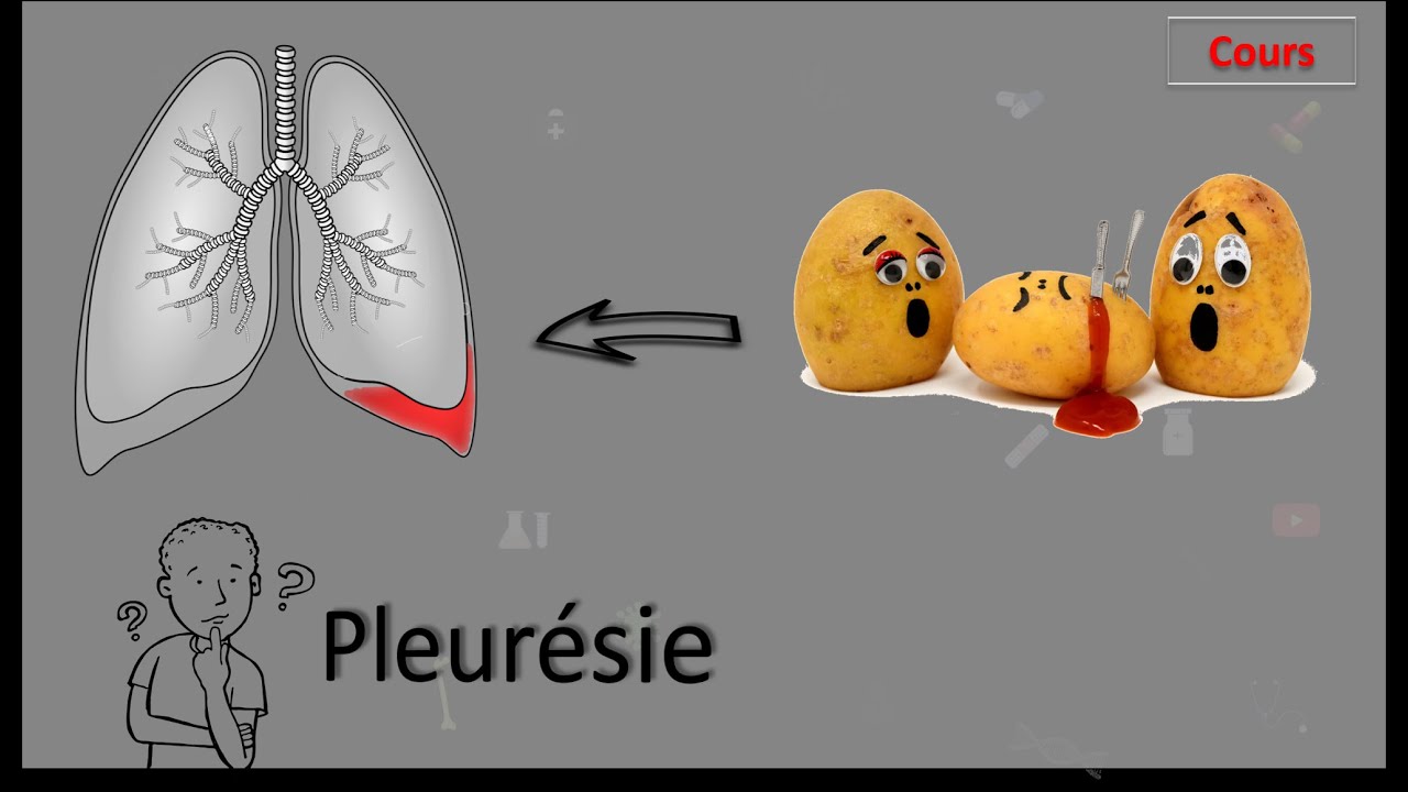 Pleurésie 🤒🤔?! Tous ce que vous devez connaître - Cours - Pneumo.Phtisiologie