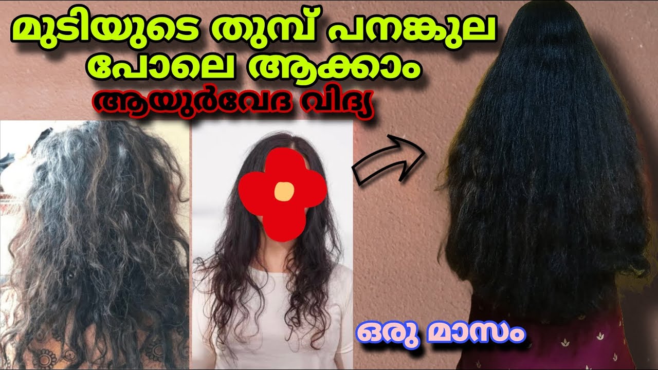 വൈദ്യൻ പറഞ്ഞു തന്ന സൂത്രം🔥 തെളിവ് കണ്ട് നോക്ക്😱Hair Thinning Home Remedy