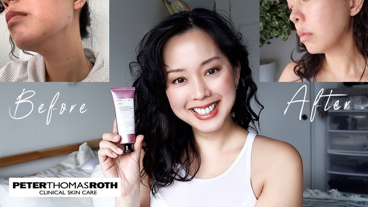 How To Get Rid of Uneven Skin Tone