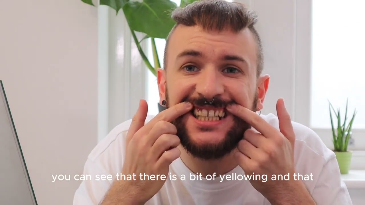 The alternative to dentures...