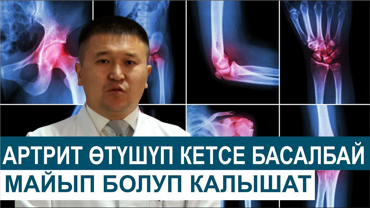 АРТРИТ ӨТҮШҮП КЕТСЕ БАСАЛБАЙ МАЙЫП БОЛУП КАЛЫШАТ//ДЕН СООЛУК