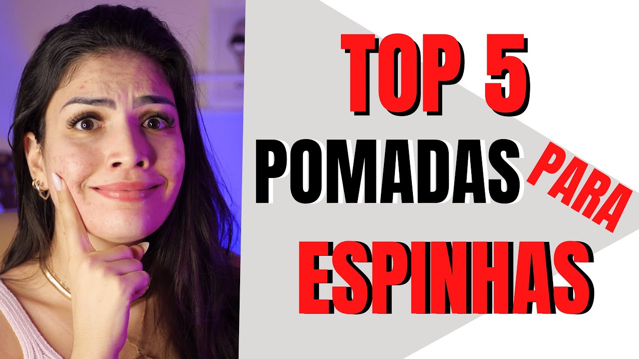 DICAS DE 5 POMADAS PARA ACABAR COM AS ESPINHAS [ACNE]