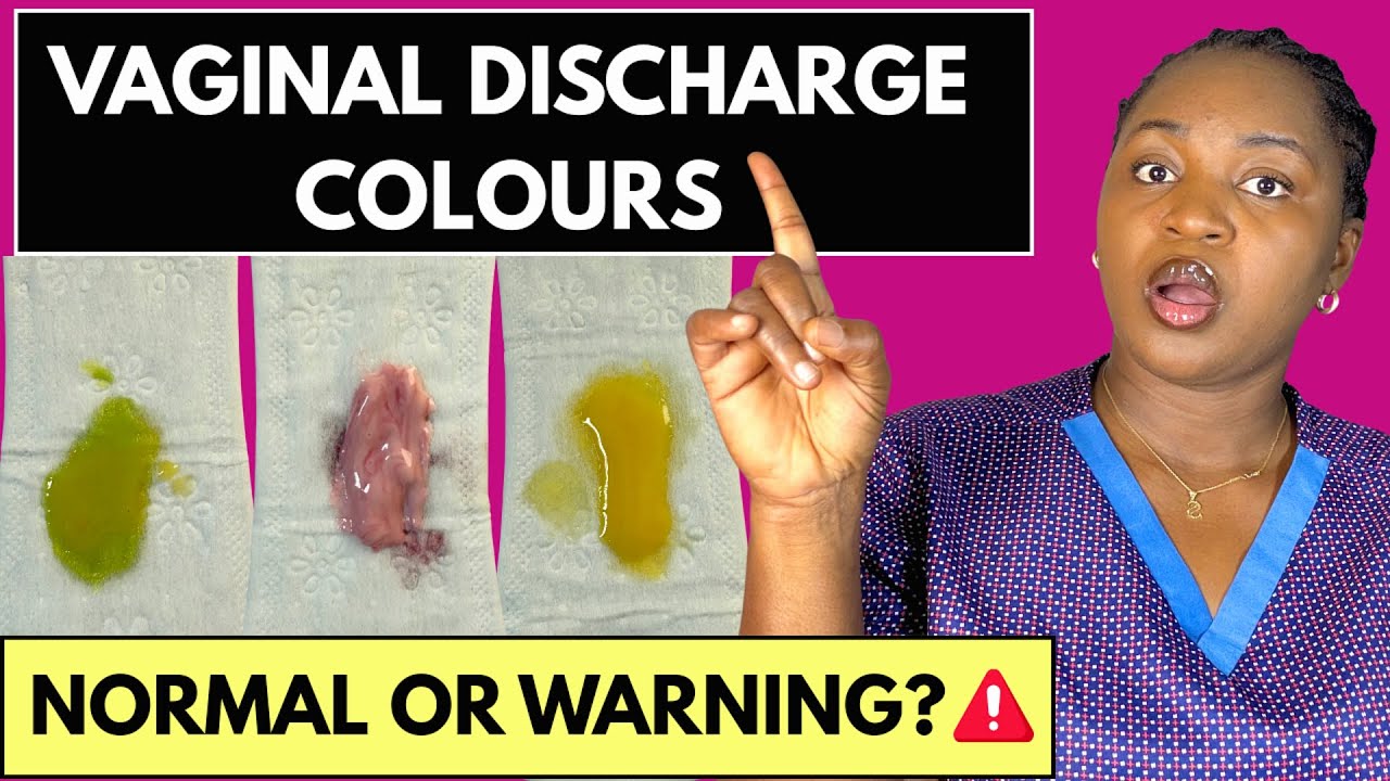 Vaginal Discharge Colours | Is My Discharge Normal:Thrush, STI, Bacterial Vaginosis, Yeast Infection