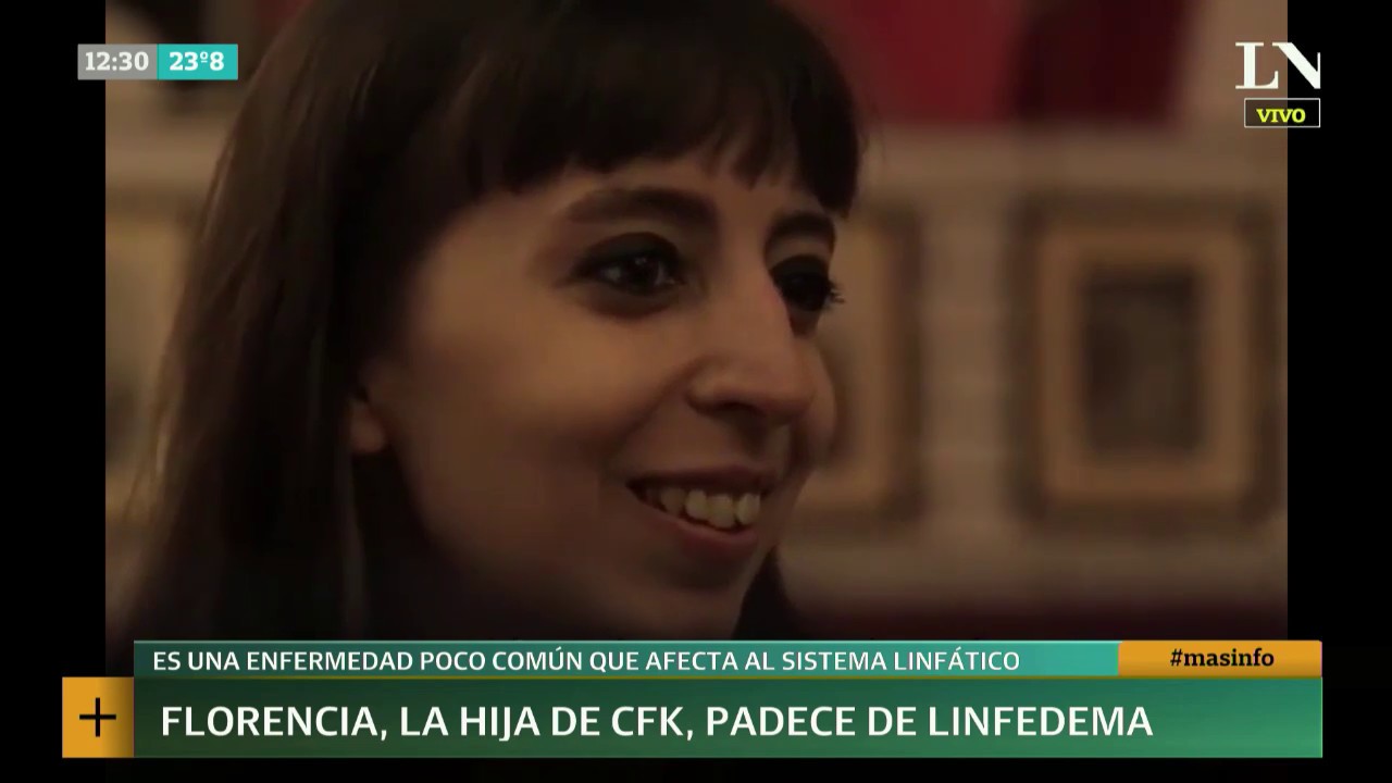 Linfedema: ¿qué es la enfermedad que padece Florencia Kirchner? | +INFO por LN+