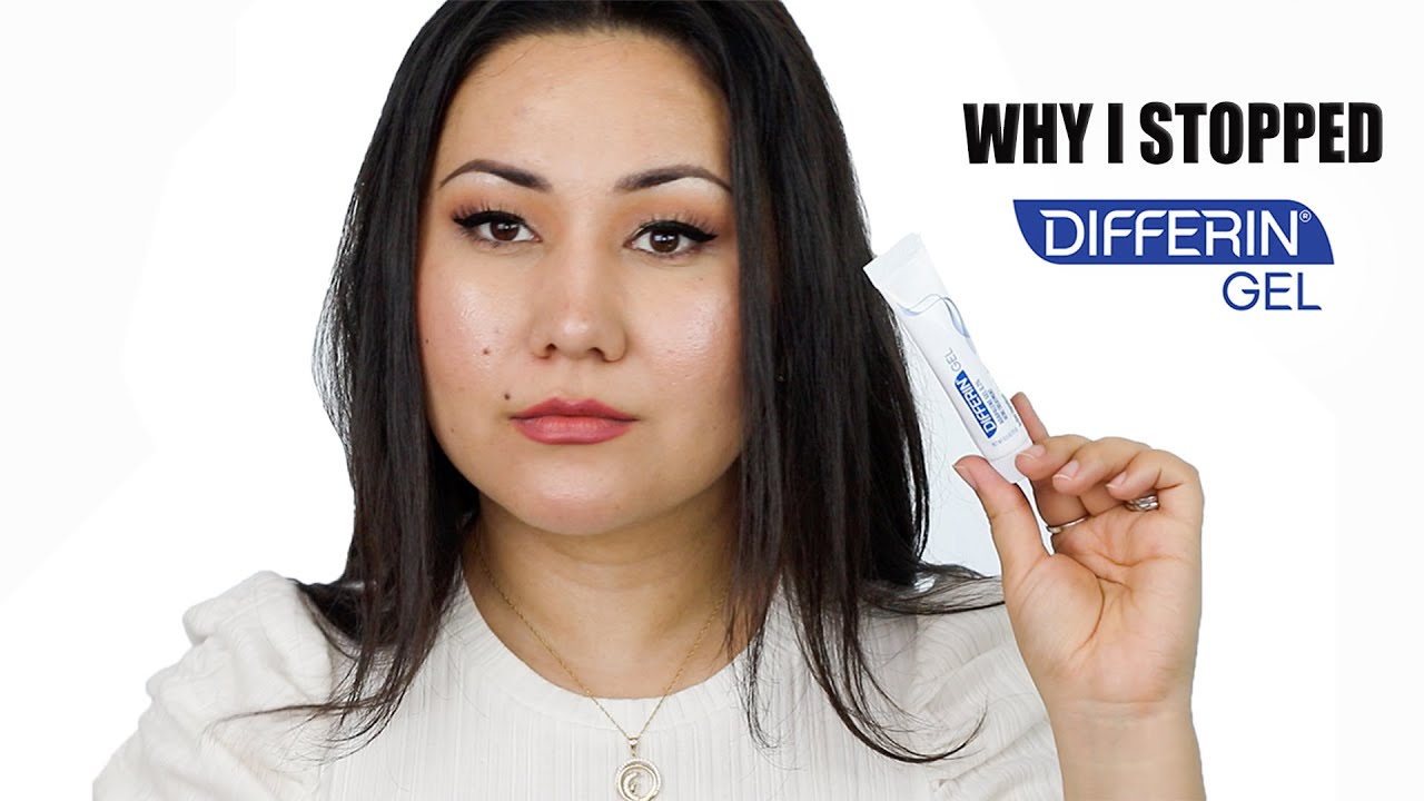 WHY I STOPPED USING DIFFERIN GEL | ADAPALENE GEL 0.1% ACNE TREATMENT | Zulayla