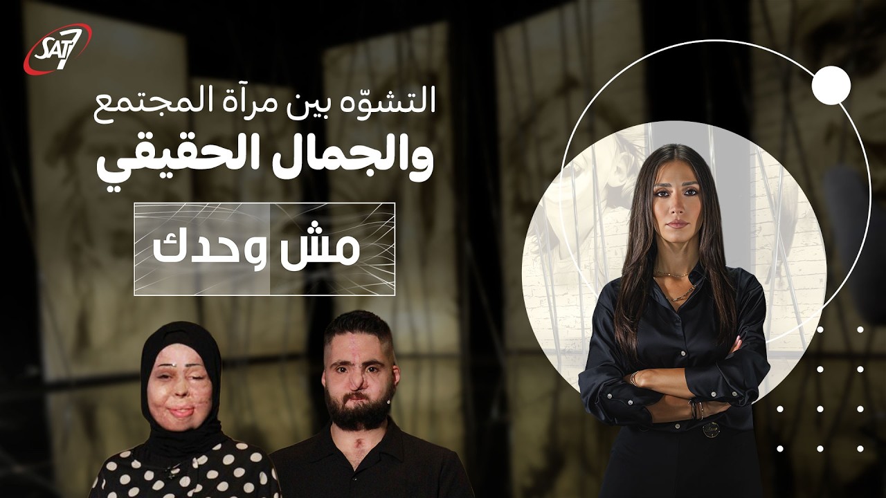 التشوّه بين مرآة المجتمع والجمال الحقيقي | مش وحدك - حلقة ١١