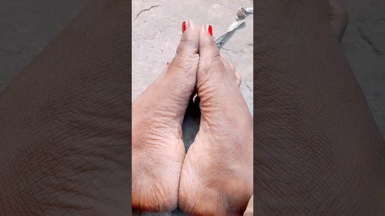 जिस औरत की पैर की एरिया फटी हुई होती है 