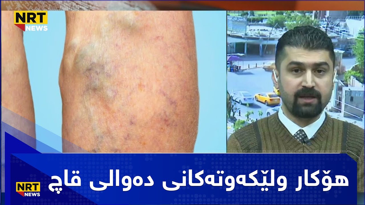 هۆكار ولێكه‌وته‌كانی ده‌والی قاچ