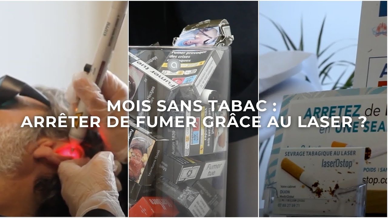 Mois sans tabac : arrêter de fumer grâce au laser ?