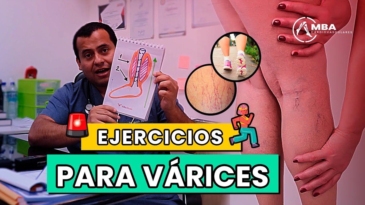 LOS 8 EJERCICIOS PARA VÁRICES /  ¿CÓMO SE HACEN? Paso a Paso explicado