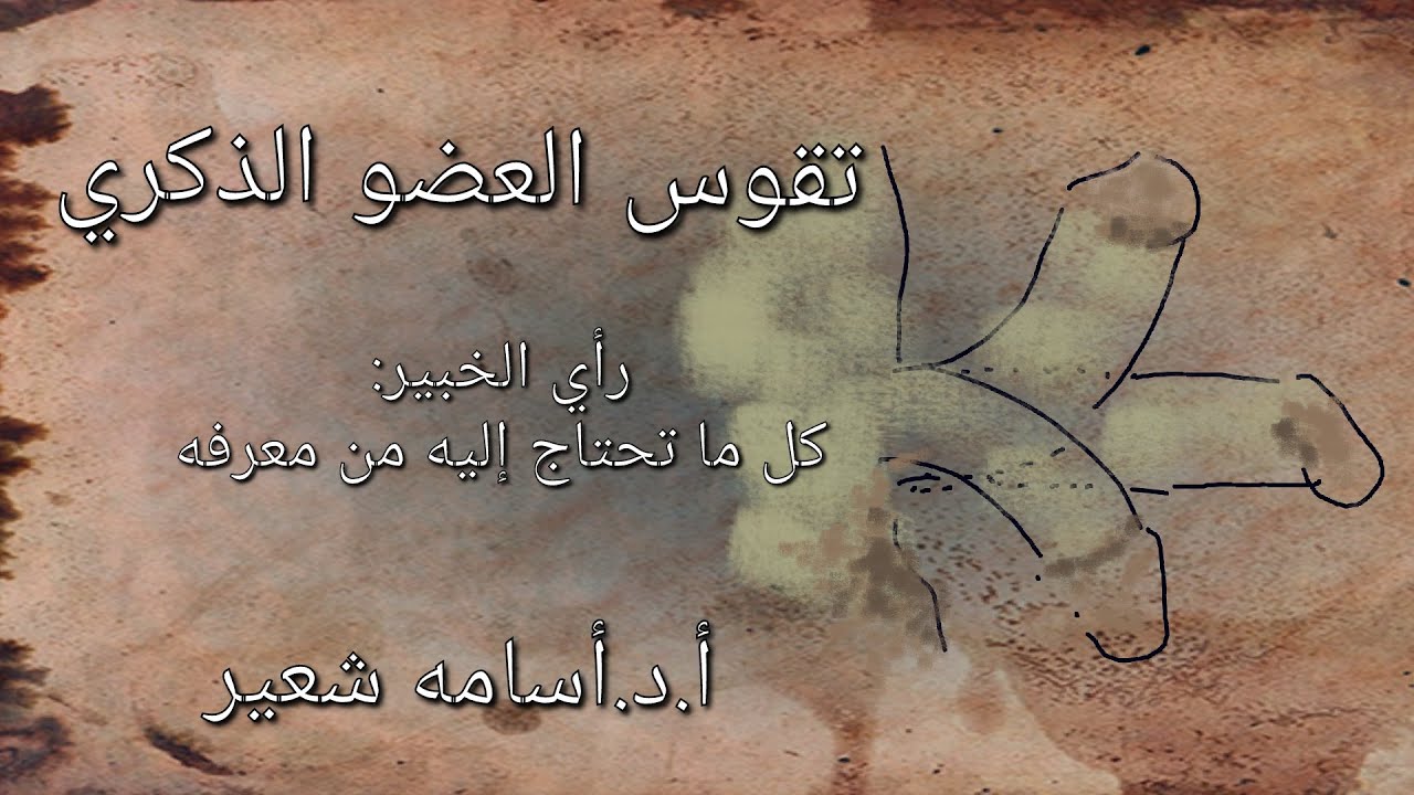 خبير الذكورة و الشرح الكامل لحالات تقوس العضو الذكري ـ إعوجاج القضيب ـ انحناء الذكر