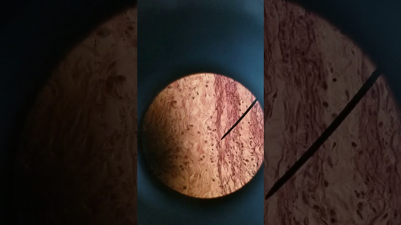 Aorta and vena cava histology