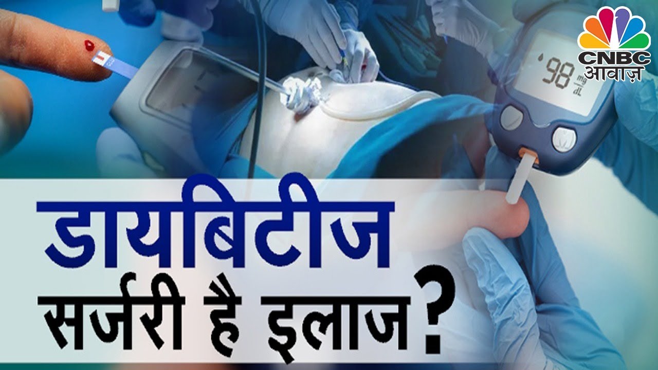 Surgery For Diabetes: डायबिटीज के लिए सर्जरी ही है एक मात्र इलाज?कैसे काम करती है Bariatric Surgery?