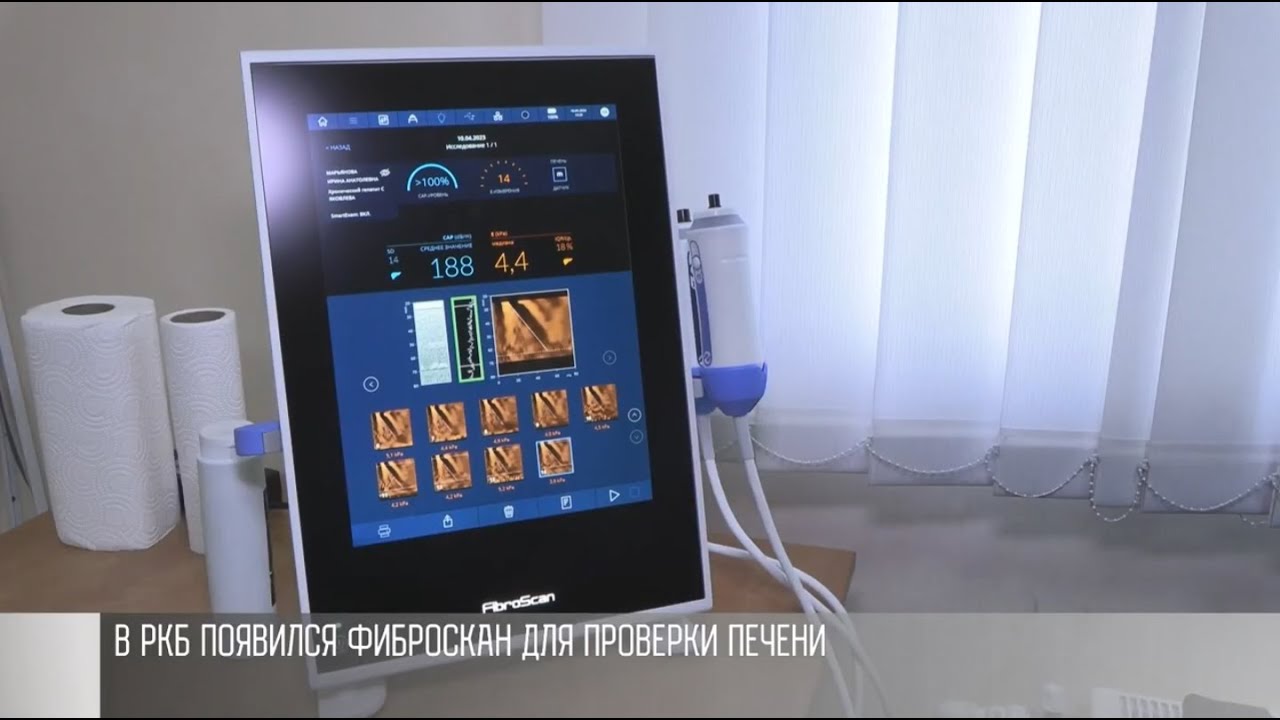В РКБ появился фиброскан для проверки печени
