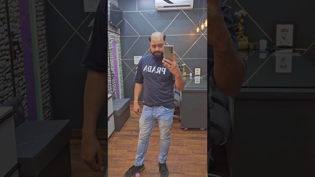 Hair Patch Transformation | Delhi Hair Fixing #hairpatches #hairtransformation