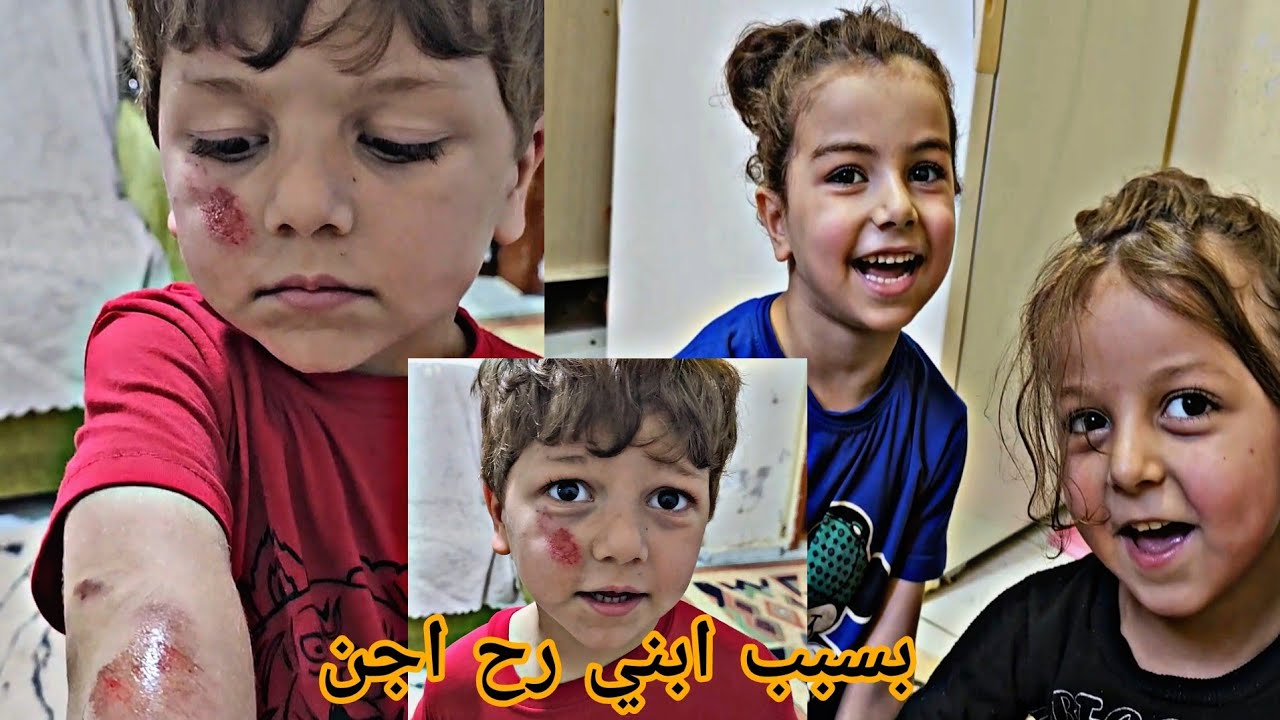 تشوه وجه وسيم بسبب ولاد الجيران/ روتينا الصبح