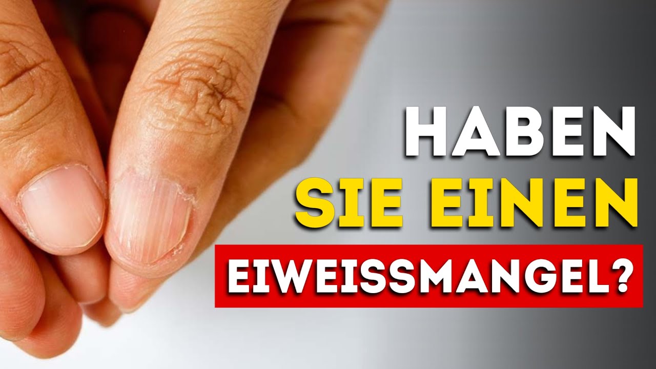 7 Anzeichen f&uuml;r Proteinmangel, die Sie nicht ignorieren d&uuml;rfen