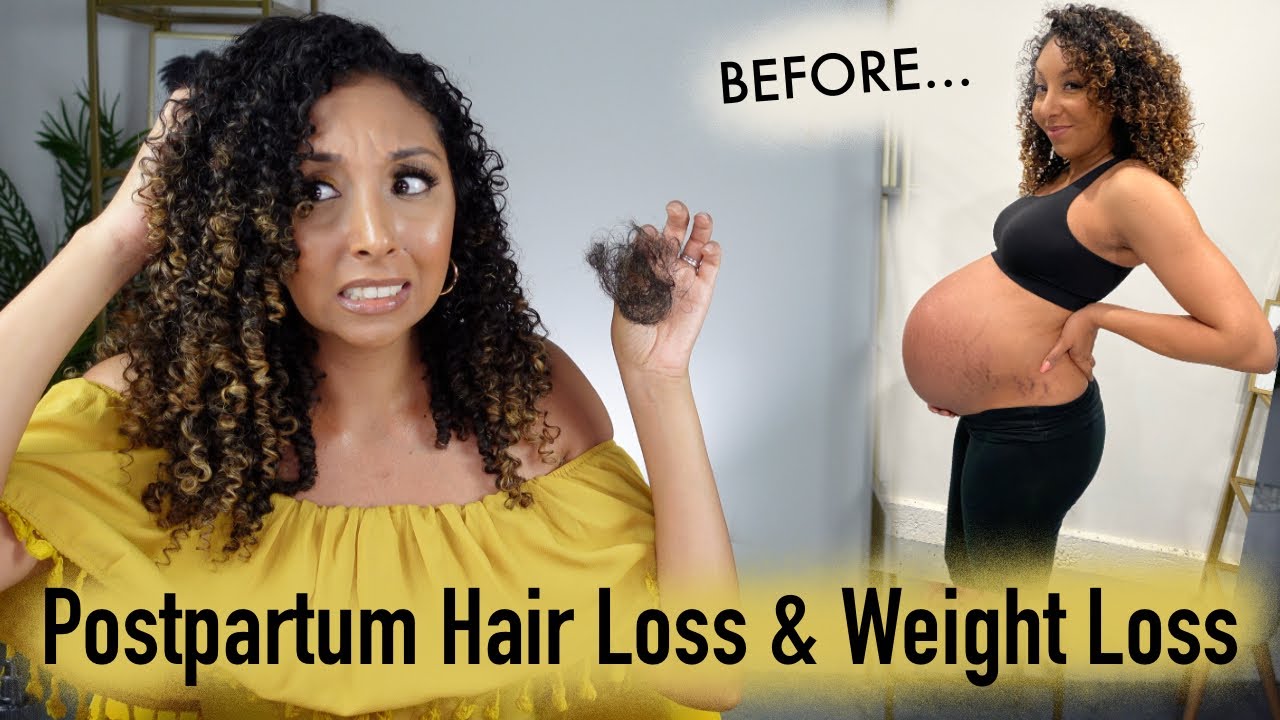 My Postpartum Hair Loss & Weight Loss Journey | BiancaReneeToday