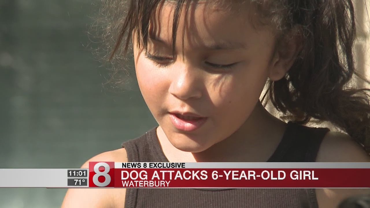 6-year-old girl attacked by pit bull