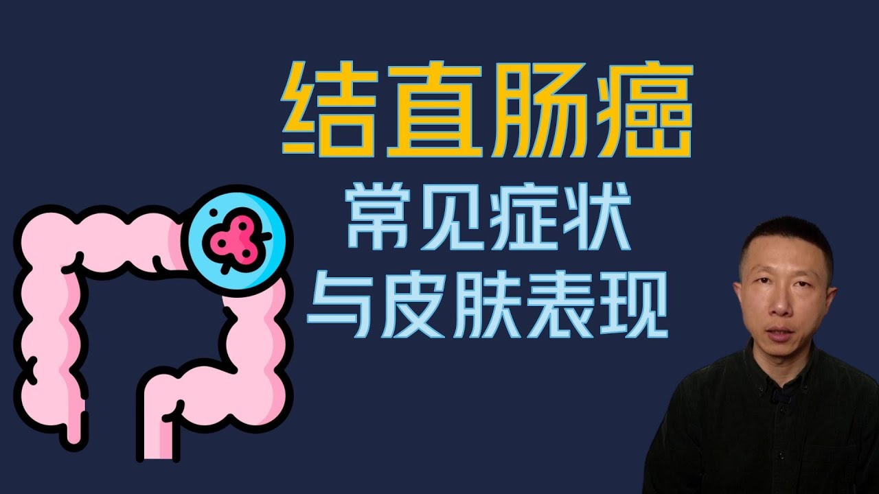 结直肠癌的7个警告信号以及皮肤上的3个奇怪表现