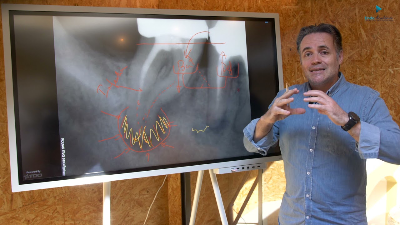 #69 Comment expliquer simplement l'endodontie à nos patients ?