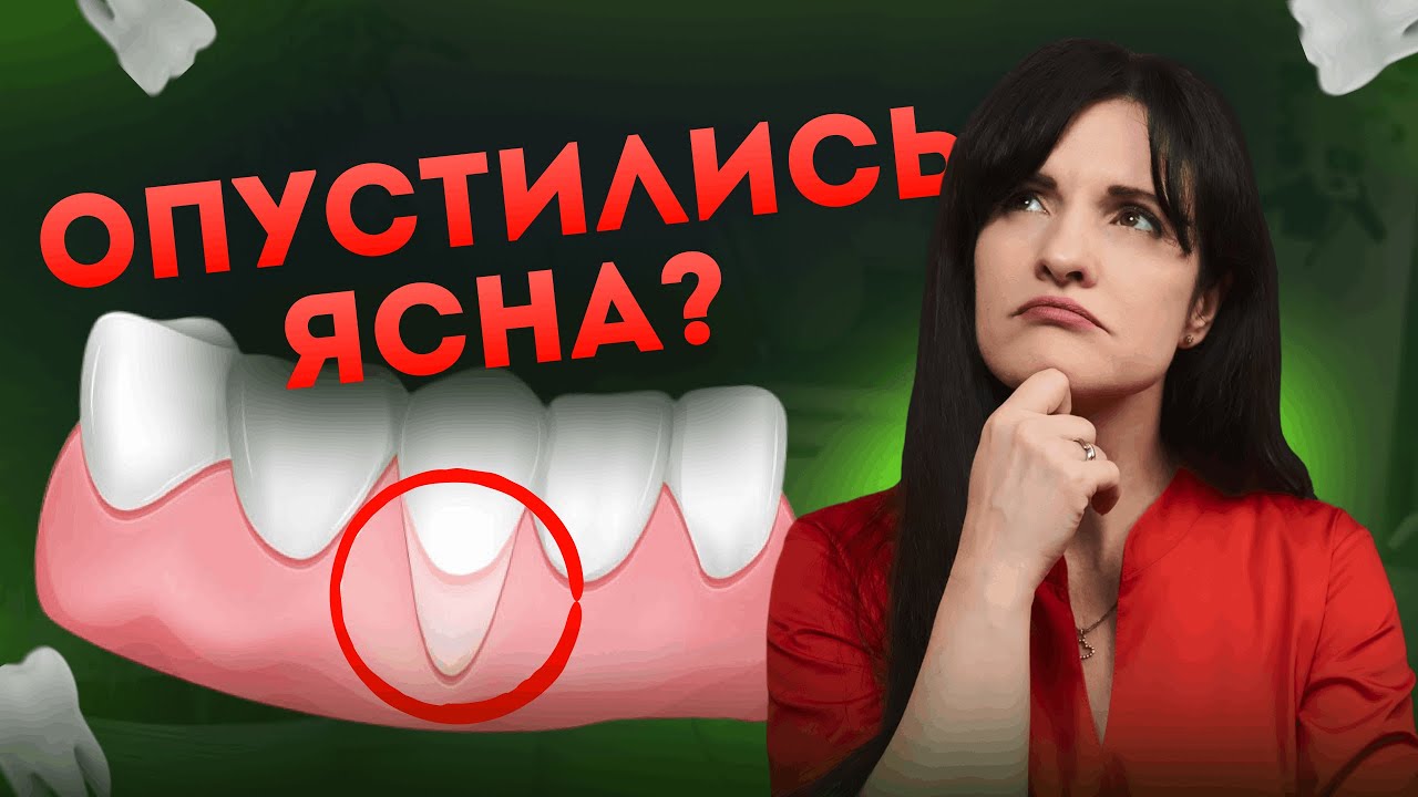 Що робити, якщо опустились ЯСНА?