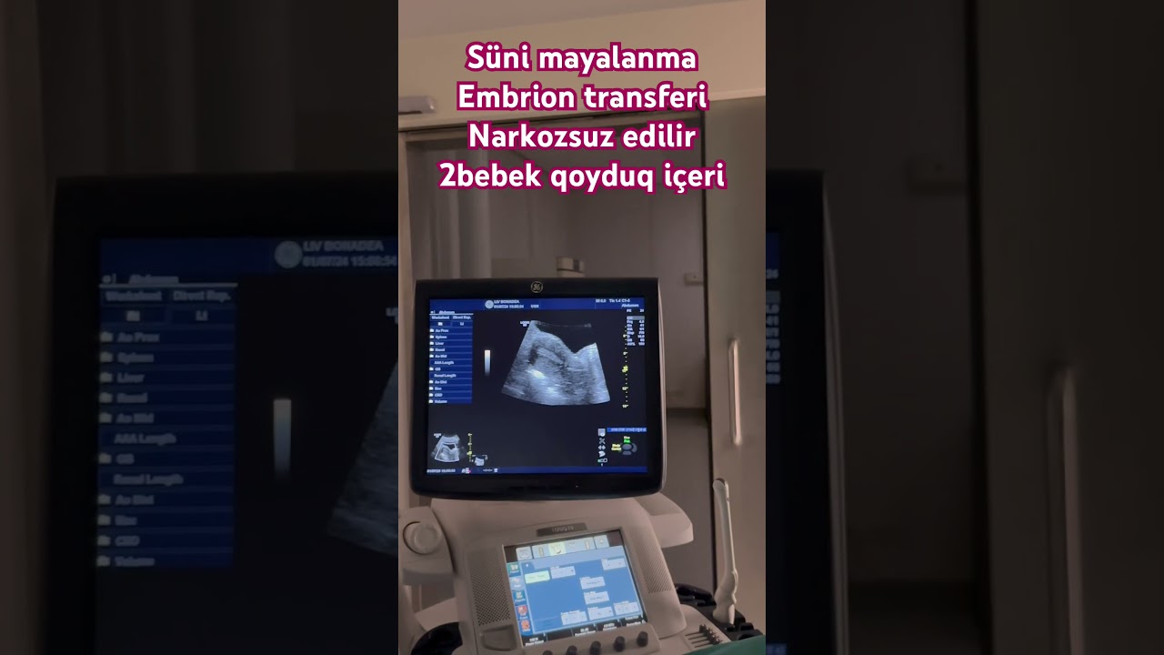 S&uuml;ni mayalanma,embrion transferi,2bebek qoyduq i&ccedil;eri,inşallah ikisi de tutar🙏 #uzmdrgunelziyadova